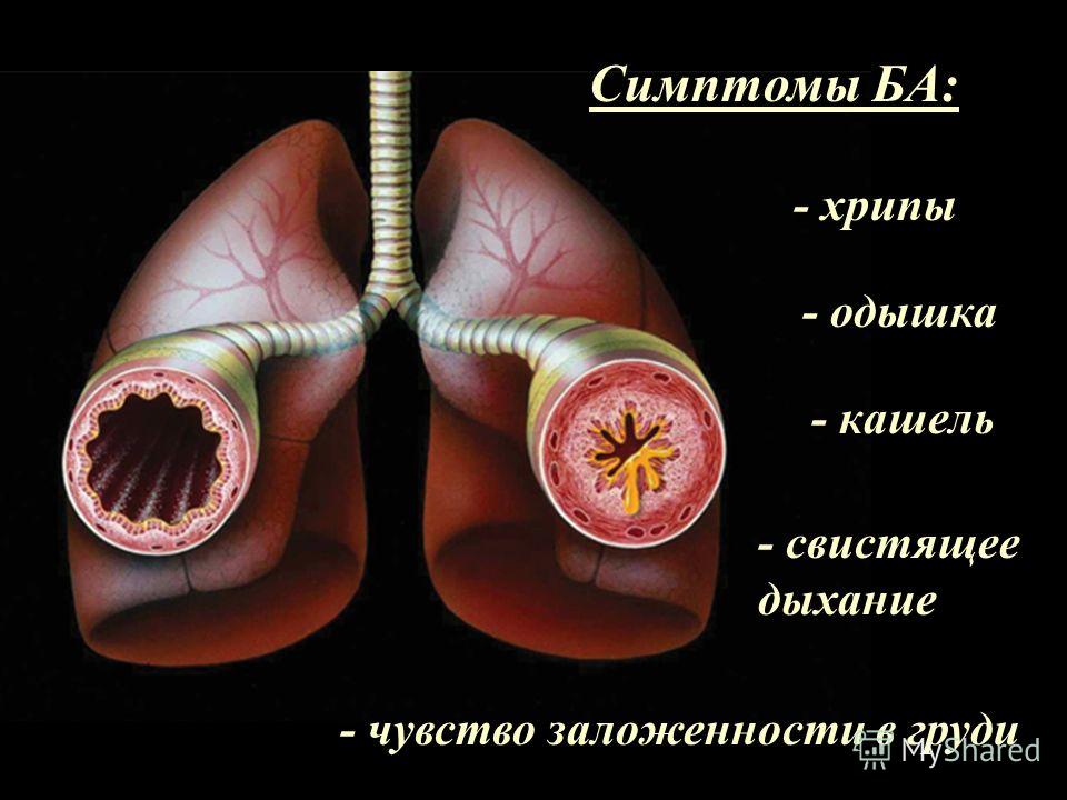если у ребенка хрипы в легких без температуры чем секрет