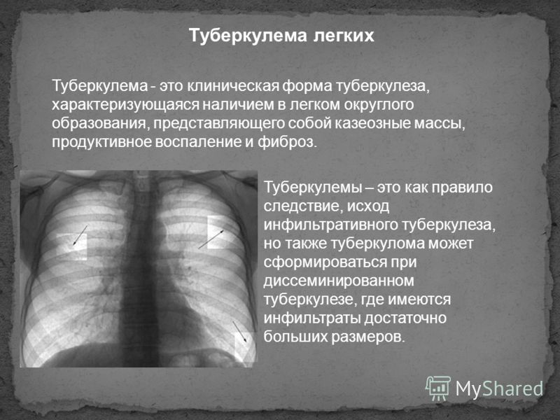 Болезнь по ногтям рук фото