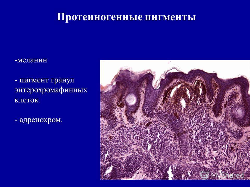 паразиты в почках человека симптомы и лечение паразиты в почках человека симптомы и лечение