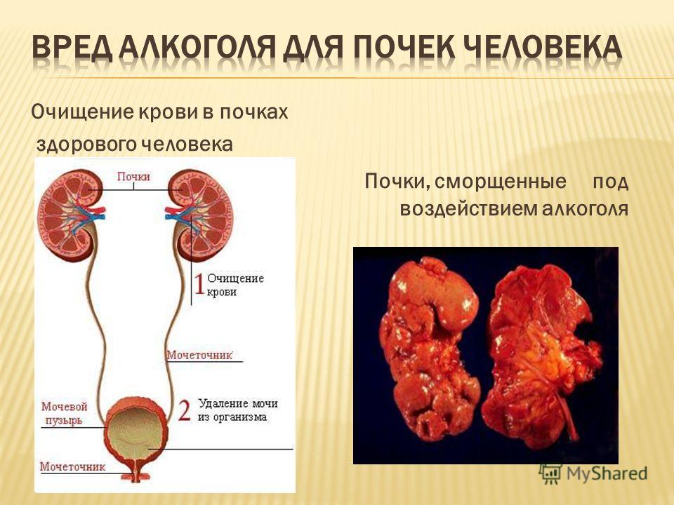 Как узнать алкоголика Как узнать алкоголика