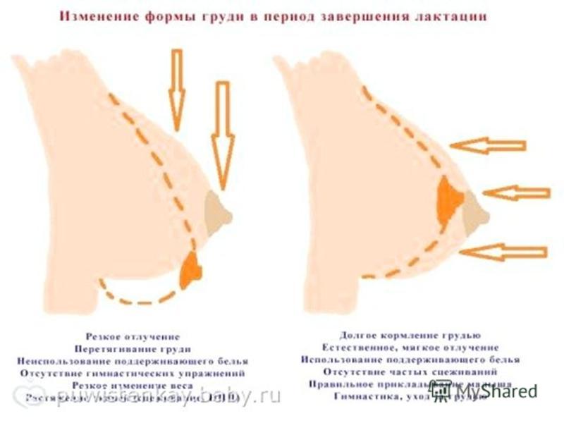Пропало грудное молоко как восстановить в домашних 239