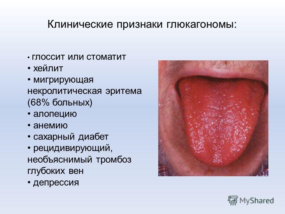 статины после стентирования статины после стентирования