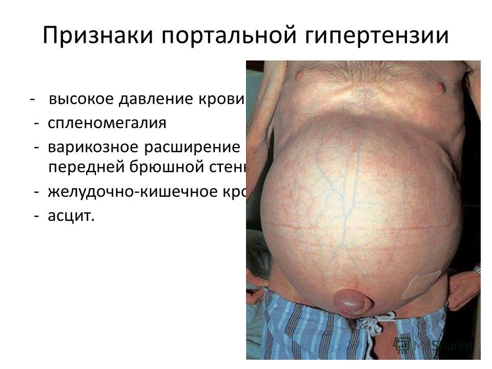 Черная кровь из вены