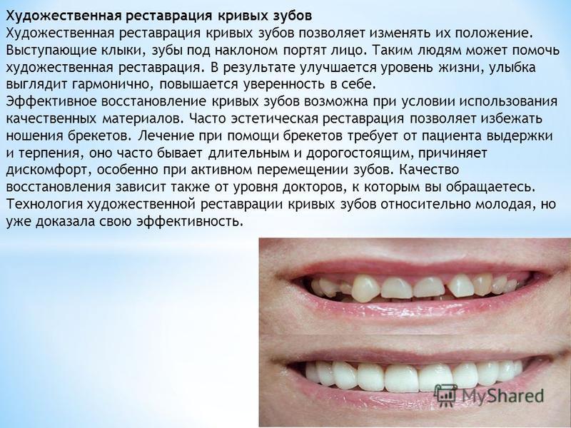 Реферат: Эстетическая реставрация в стоматологии