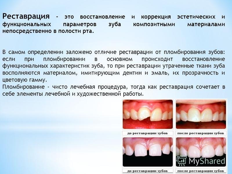 Восстановление и сохранение окклюзии в реставрационной стоматологии презентация