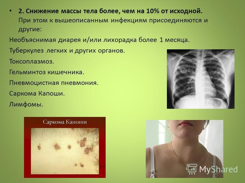 Как выглядит туберкулез кожи у человека фото Презентация на тему: "Государственное бюджетное профессиональное образовательное