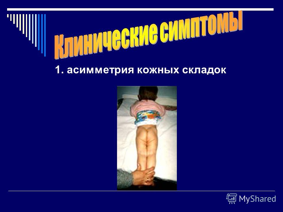 Болит сильно пятка больно наступать