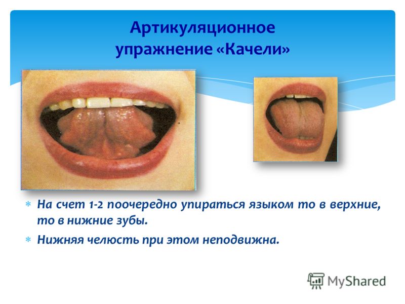 Зарядка для верхней губы Зарядка для верхней губы