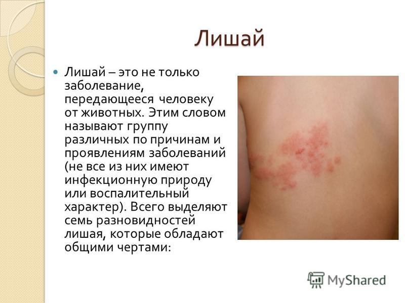 Заболевания связанные с кровеносными сосудами Заболевания связанные с кровеносными сосудами