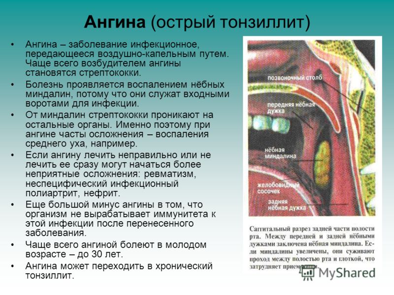 Мононуклеоз у детей симптомы и лечение осложнения