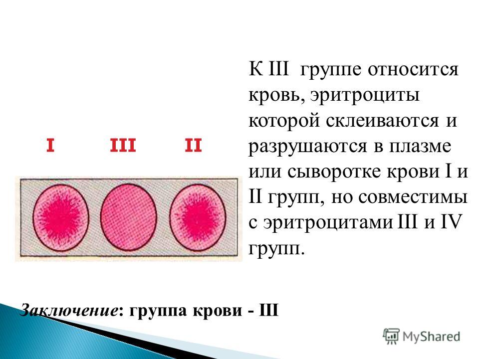 К III группе относится кровь, эритроциты которой склеиваются и разрушаются в плазме или сыворотке крови I и II групп, но совместимы с эритроцитами III
