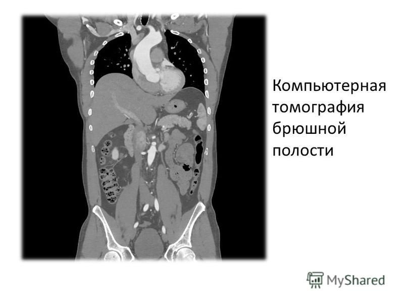Мскт Брюшной Полости В Омске Цена