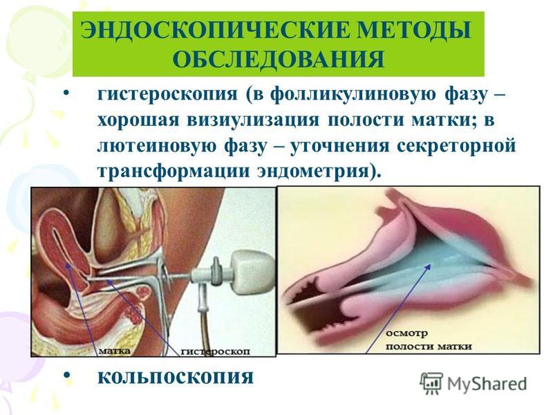 Методы исследования в гинекологии