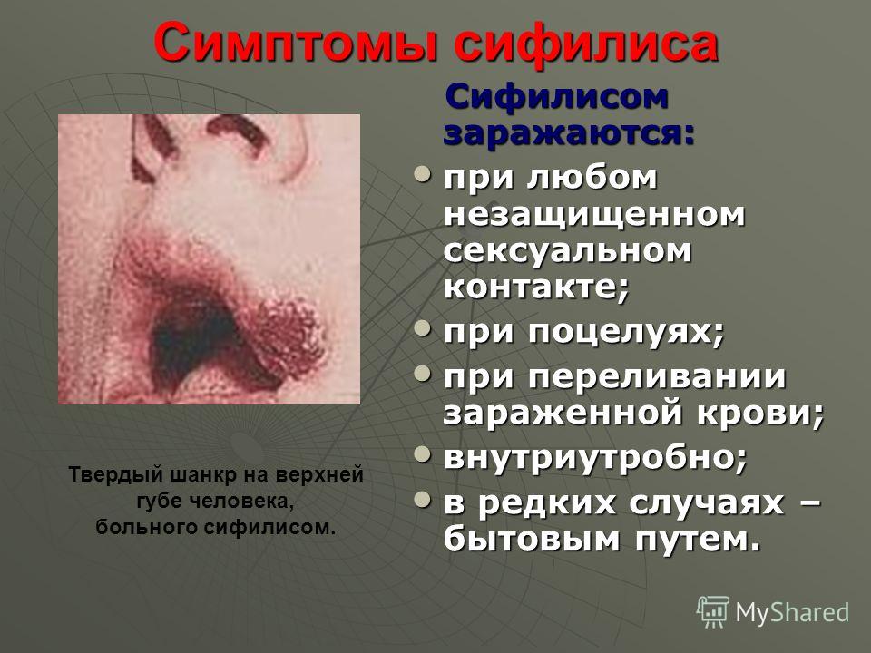 паразиты в мочевом пузыре человека фото паразиты в мочевом пузыре человека фото