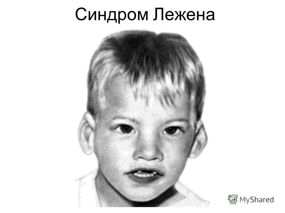 Анемия с чем это связано Анемия с чем это связано