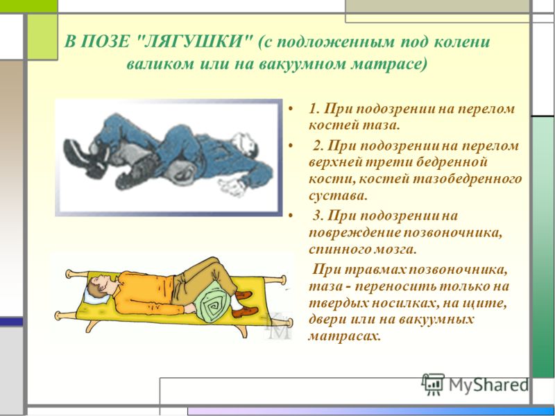 ервая медицинская помощь в походе картинки 800 x 600 · jpeg ервая медицинская помощь в походе картинки 800 x 600 · jpeg