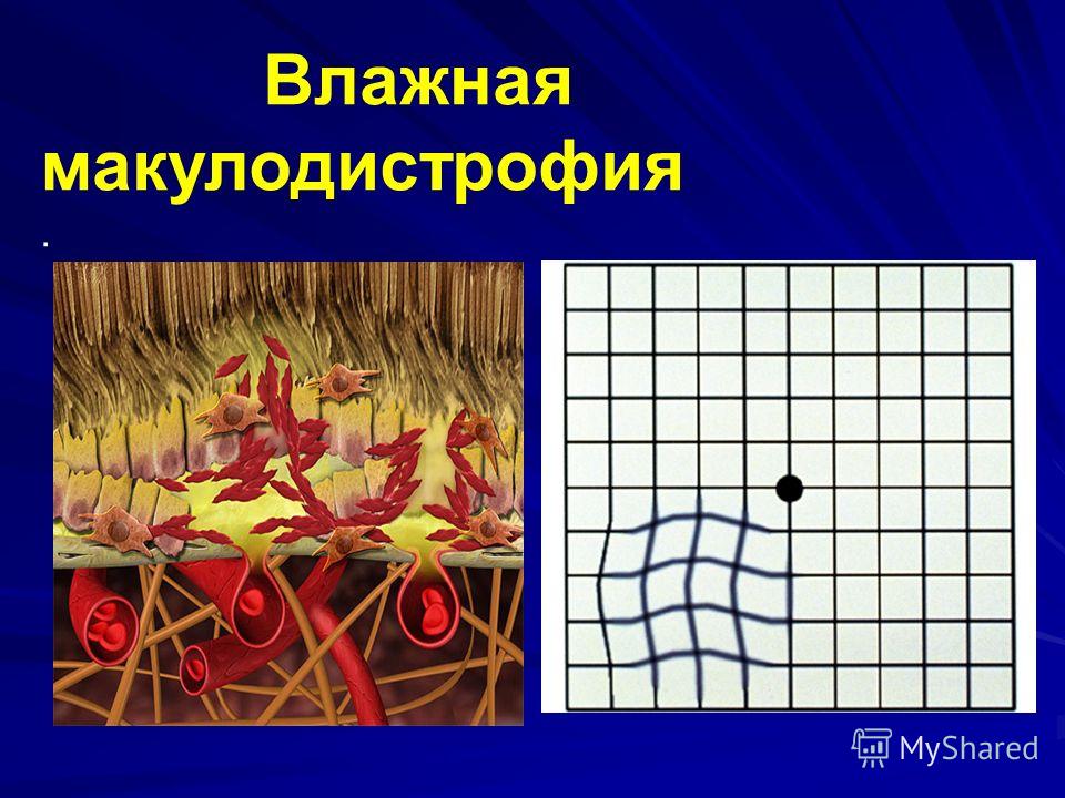 Антиэйджинговая терапия Антиэйджинговая терапия