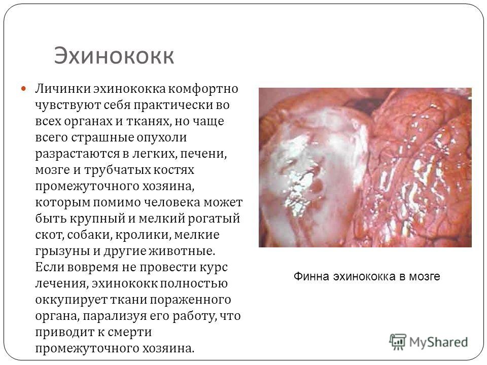 паразиты в мозге человека лечение паразиты в мозге человека лечение