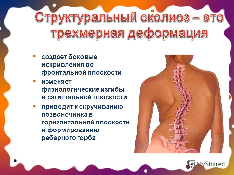 Как делать массаж при искривлении Как делать массаж при искривлении