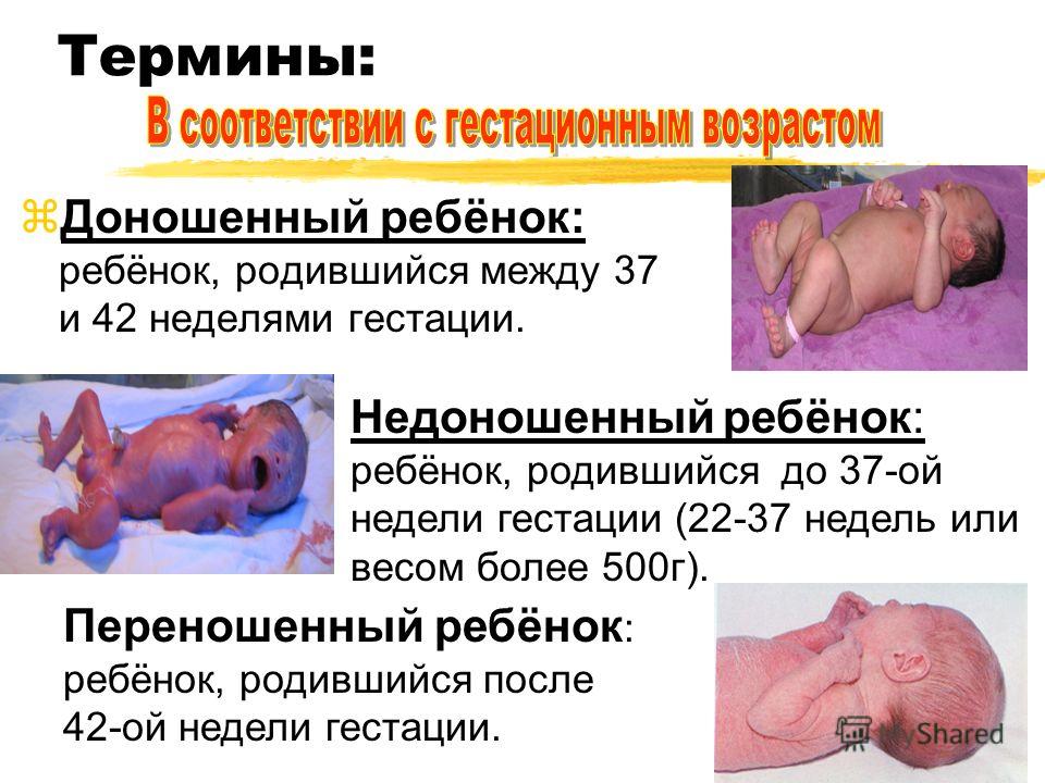 Признаки недоношенного ребенка и уход за ним Признаки недоношенного ребенка и уход за ним