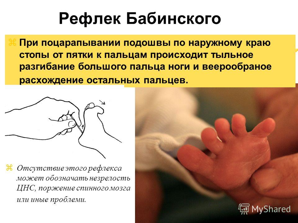 какие рефлексы проверяет невролог у взрослого были праотец евреев