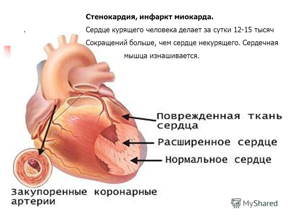 С чем может быть связано частое сердцебиение С чем может быть связано частое сердцебиение