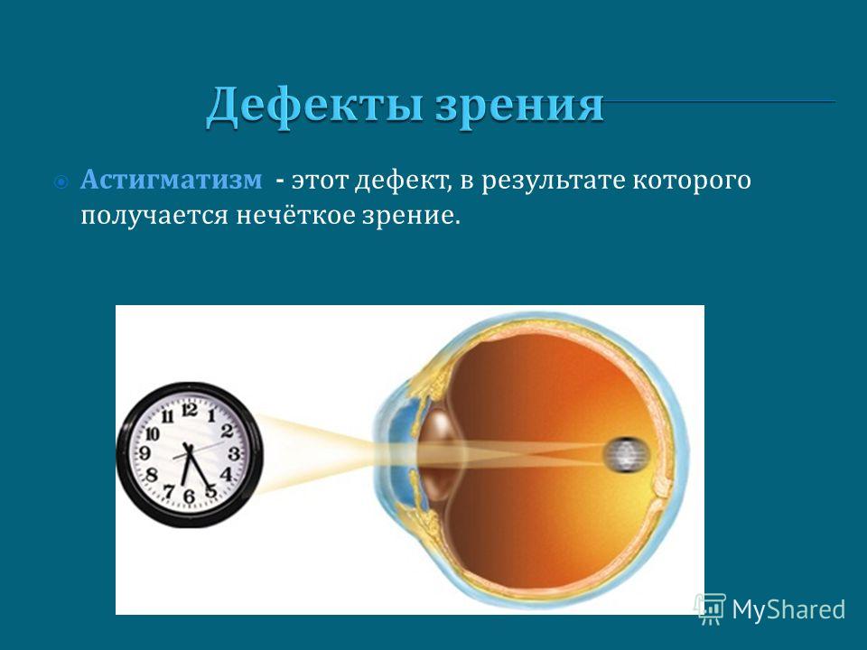 Дальнозоркость витаминные капли для