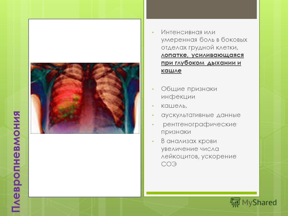 Головные боли при кормлению грудью