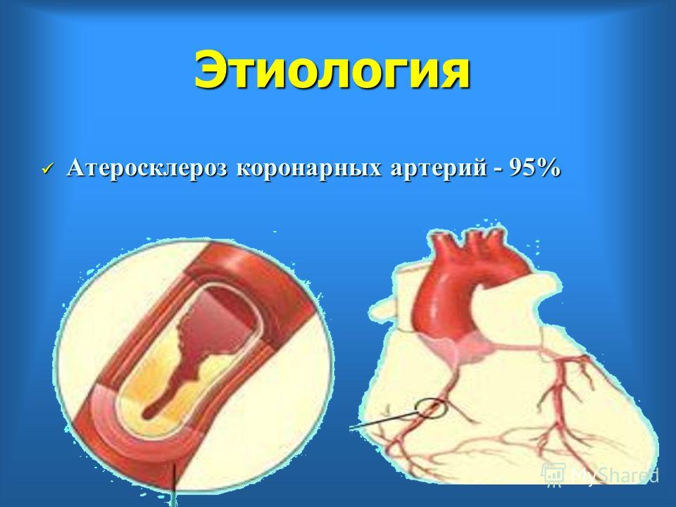 Как в анализах найти холестерин