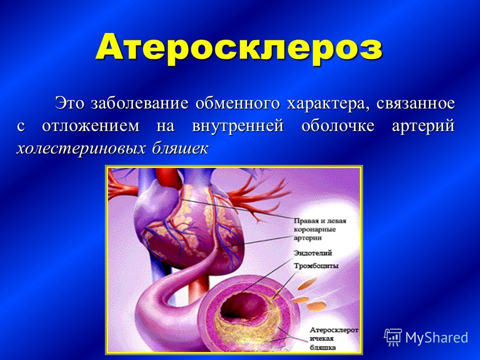 _infanata (natahaus) - Библиотека Ихтика