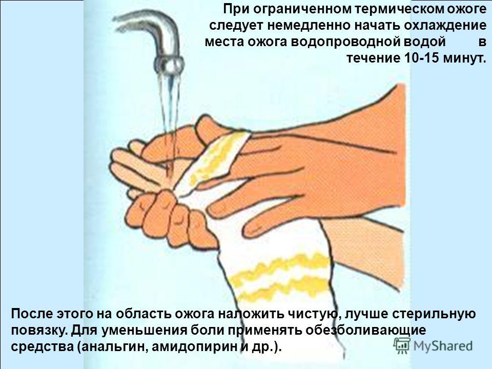 [PUNIQRANDLINE-(au-dating-names.txt) 43 Реферат по обж обморожение 7513