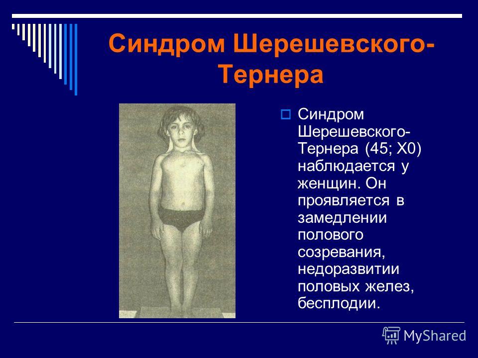 Боли в запястьях при беременности