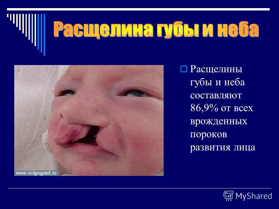 Описание губ в истории болезни Описание губ в истории болезни