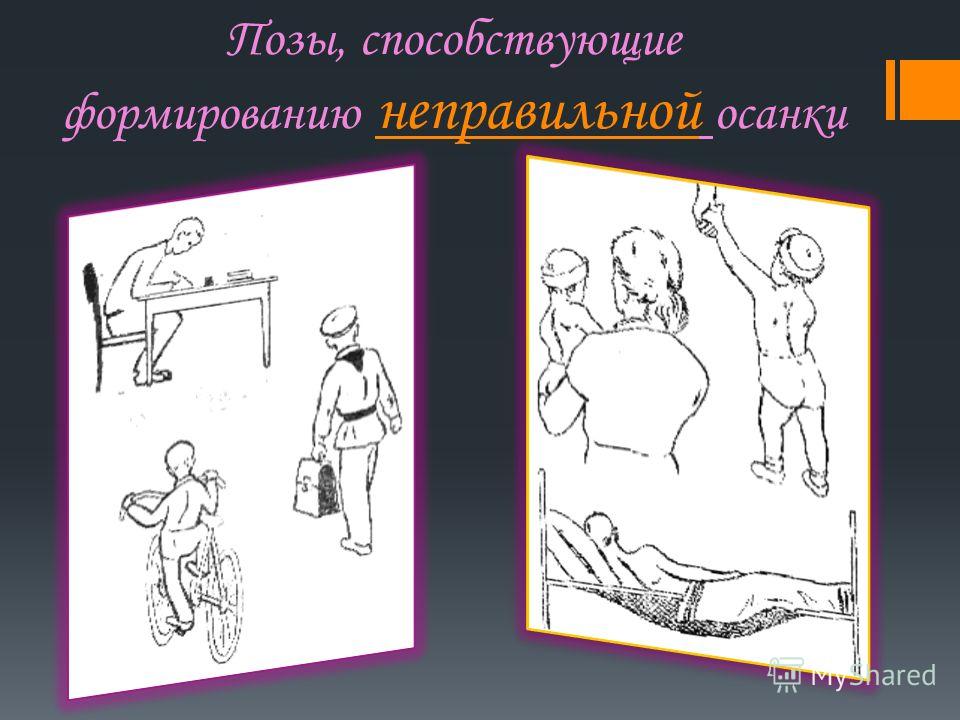 Упражнения для коррекции осанки у детей при сколиозе