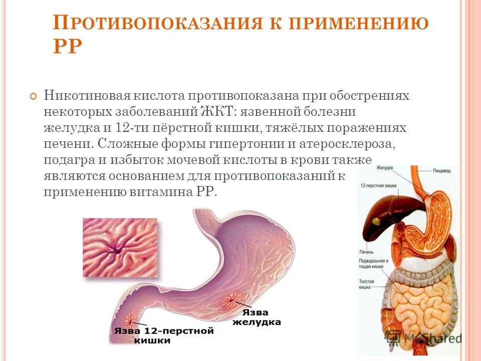 запах изо рта печень лечение запах изо рта печень лечение