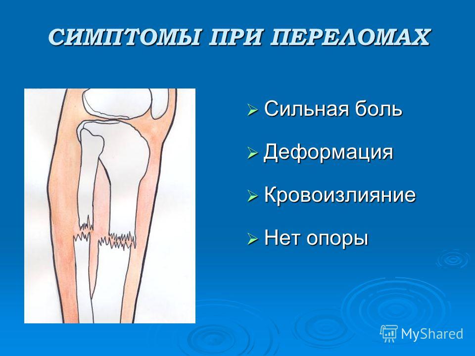 МРТ (Магнитно-резонансная томография) : МИБС Лечение поясничного радикулита медикаментами: уколы, мази
