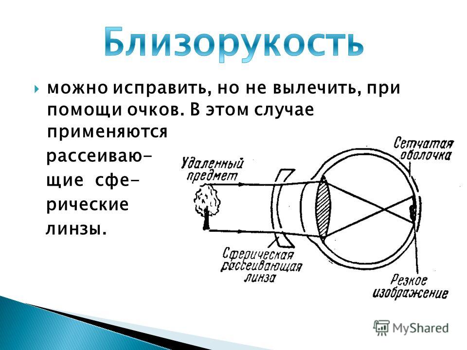 К в домашних условиях близорукость 837