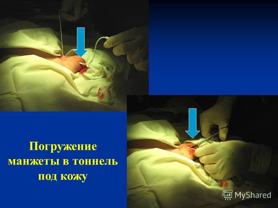 Клиника эксимер город новосибирск
