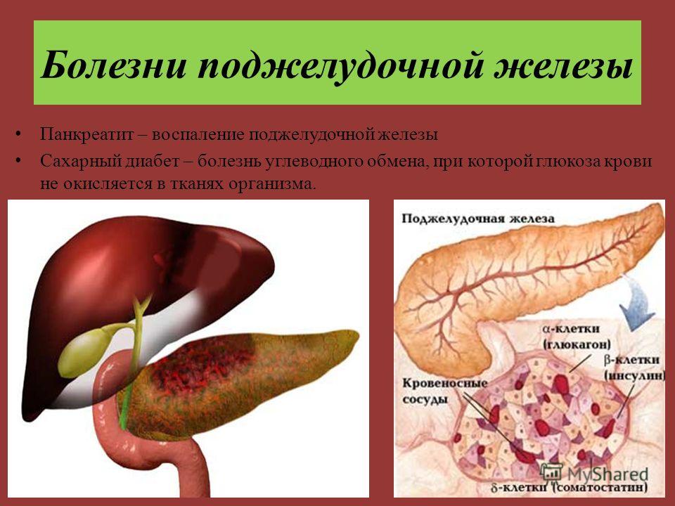 Диета При Панкреатите При Сахарном Диабете