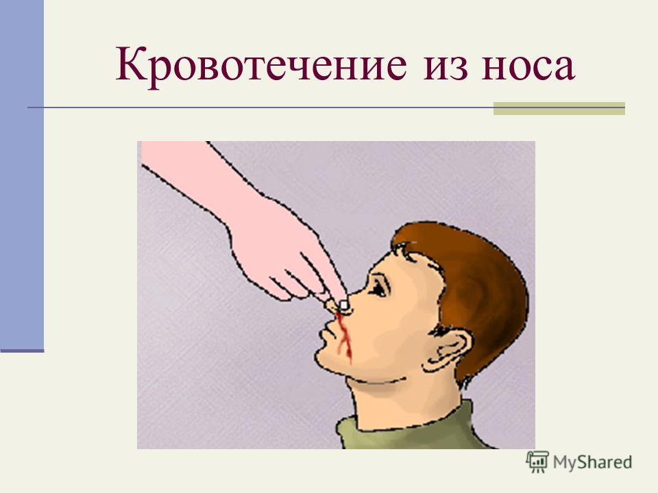 Как сделать шла кровь из носа 285