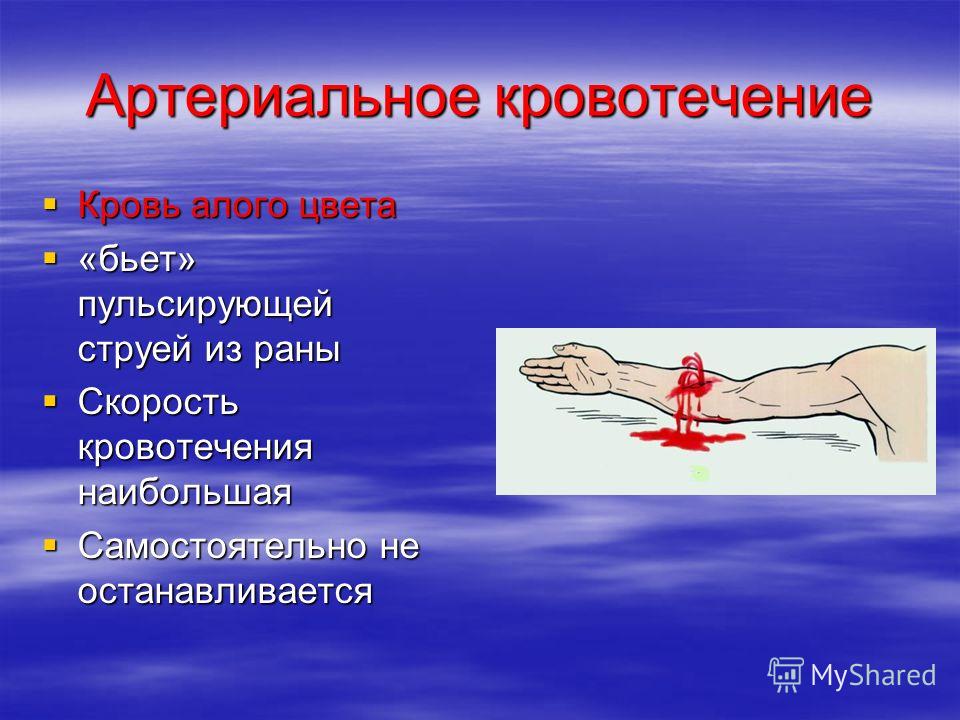 почему кровь алого цвета почему кровь алого цвета