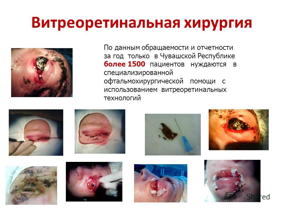 Отзывы о 86 поликлиники спб