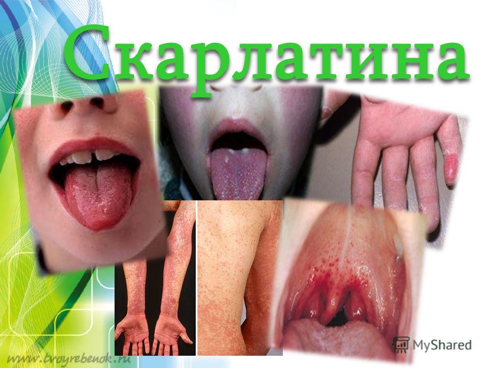 Как удалить и что это 6 Как удалить и что это 96
