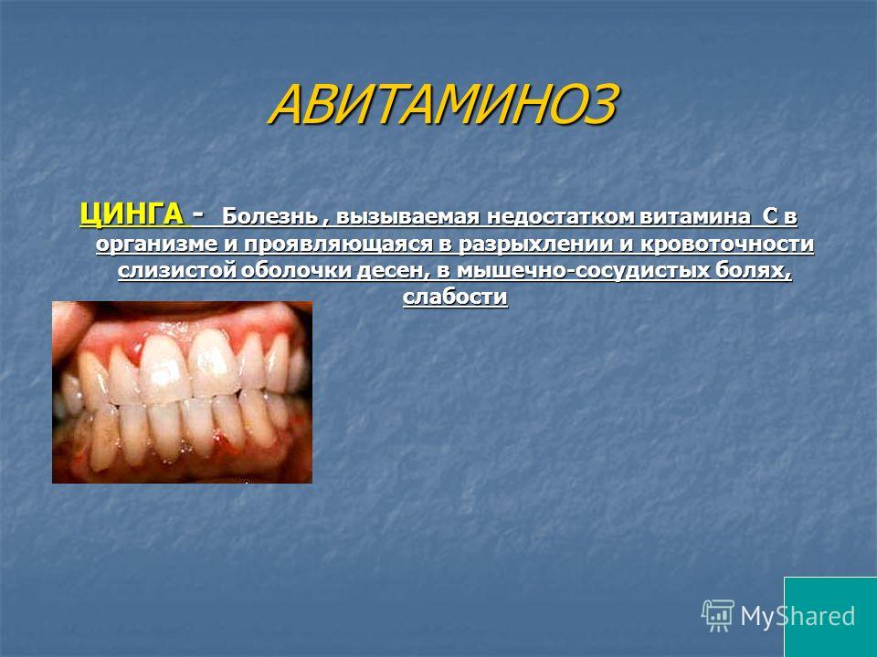 Белые прыщи на губах: внутри - Заболевания и проблемы кожи «Ногти к чему снятся во сне? Если видишь во сне Ногти, что