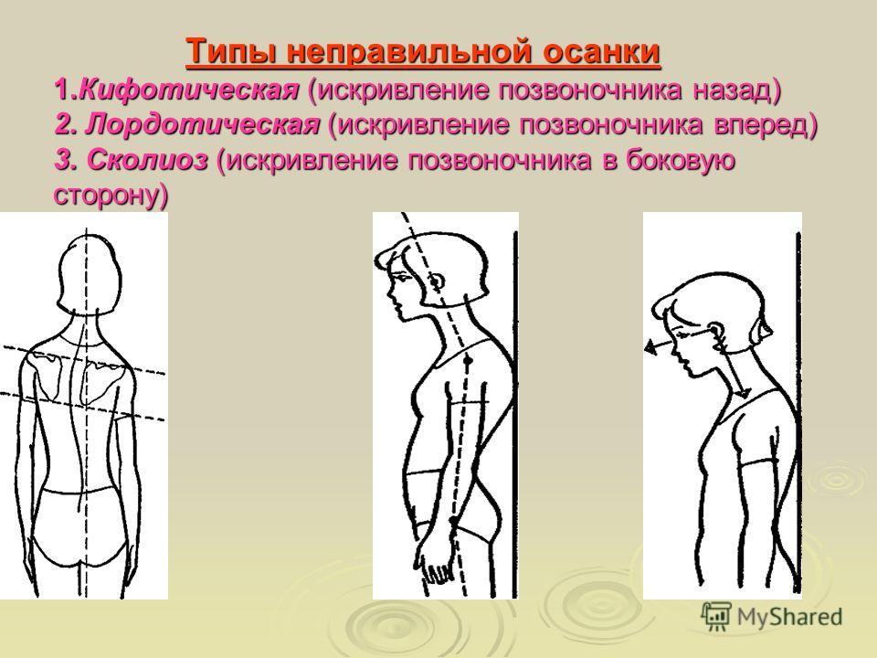 Поясничный корсет чебоксары