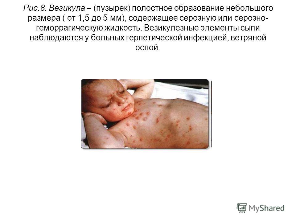 Боли сбоку живота на 28 неделе