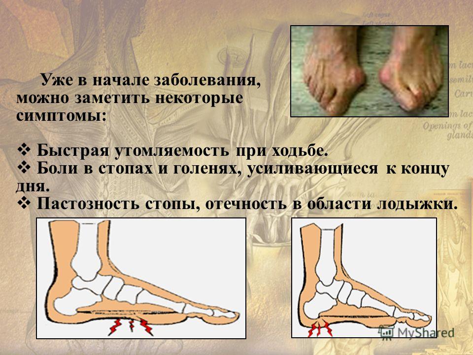 Боль тазобедренного сустава при ходьбе лечение Боль тазобедренного сустава при ходьбе лечение