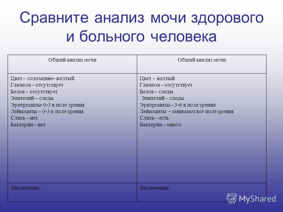 Плоский эпителий в моче у беременной что это значит у 24