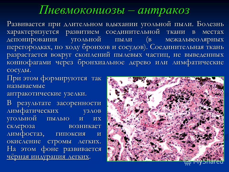 Боль в пояснице больно вставать