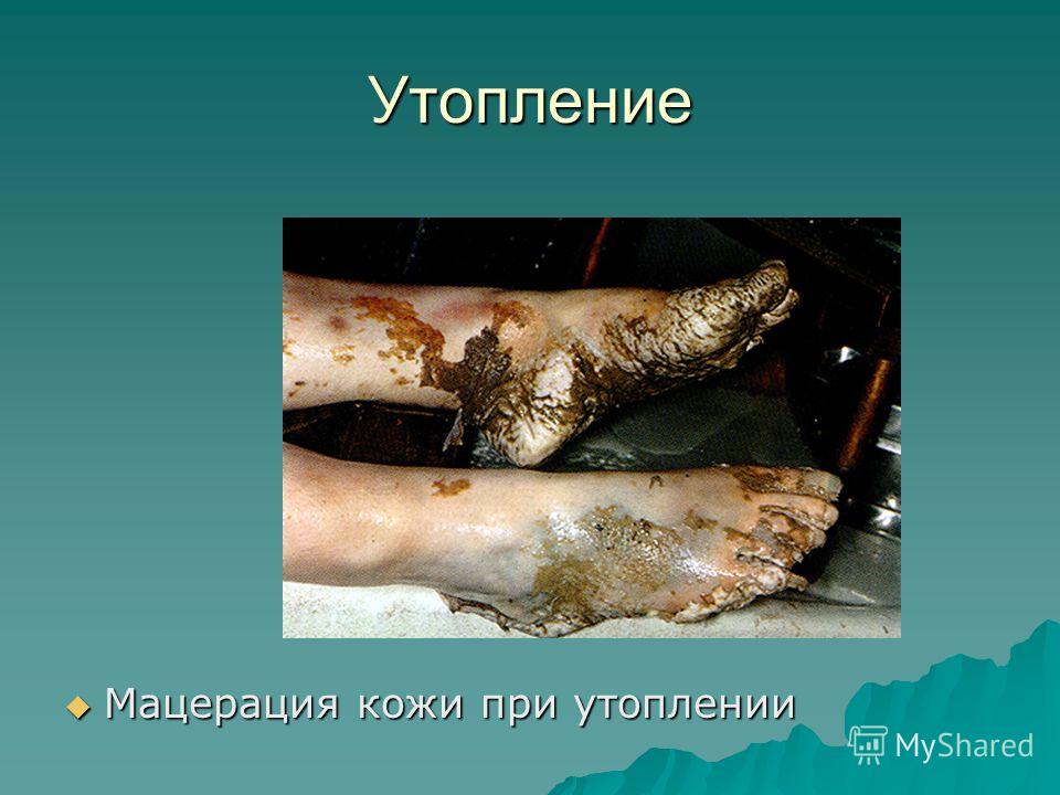 Профессиональное оборудование для салонов красоты Отбеливание зубов в домашних условиях, лазерное